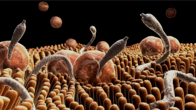 8 shocking things that happen when you don’t deworm your intestines