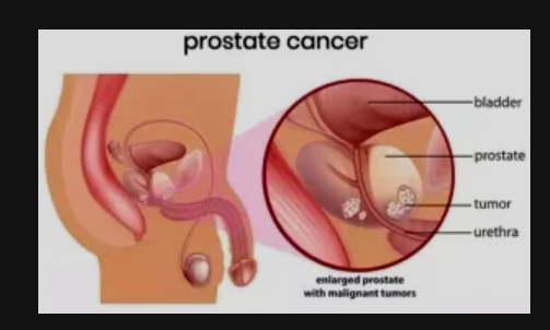 What Some Men Do On A Regular Basis That Can Cause Prostate Problems What Some Men Do On A Regular Basis That Can Cause Prostate Problems
