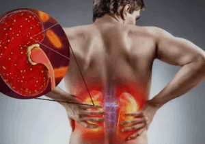You are killing your kidney slowly with these 7 practices
