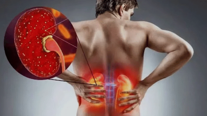 You are killing your kidney slowly with these 7 practices You are killing your kidney slowly with these 7 practices